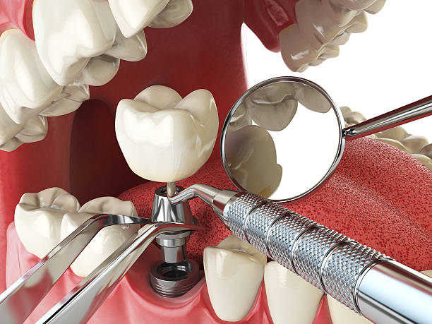 Best Emergency Orthodontic Repairs in Lenoir City, TN